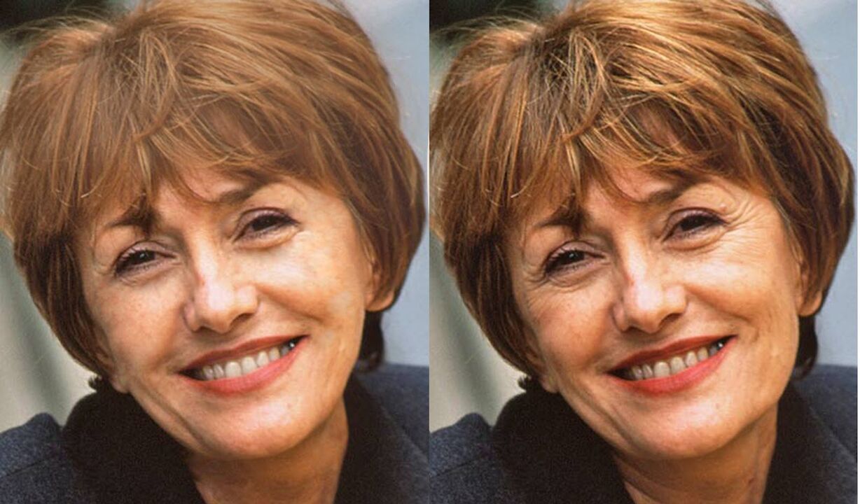 foto do rosto antes e depois do contorno