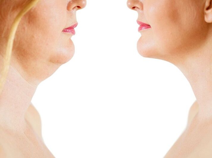 causas do envelhecimento da pele no pescoço